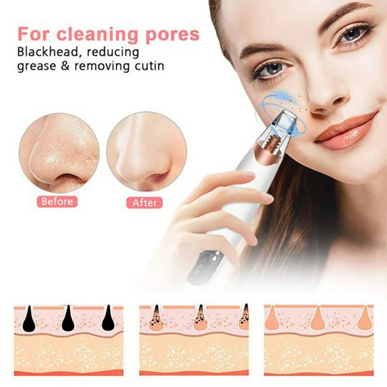 Blackhead Suction Machine